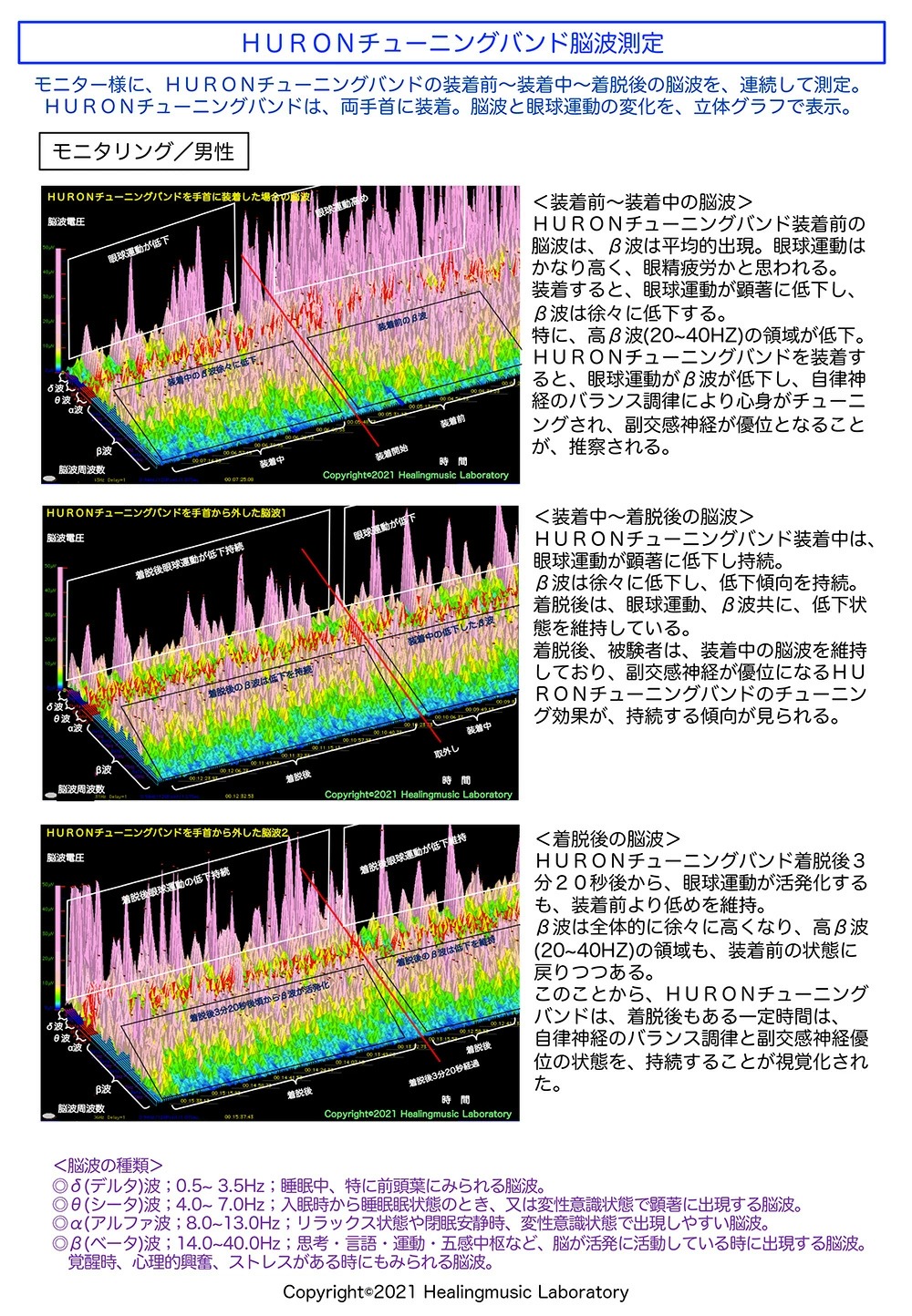 HURON チューニングバンド脳波測定